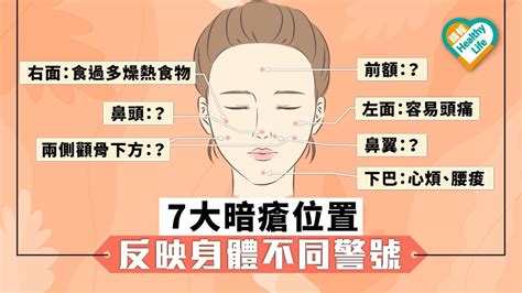 上唇 暗瘡|【暗瘡位置】不同代表什麼？中醫教如何處理及預防